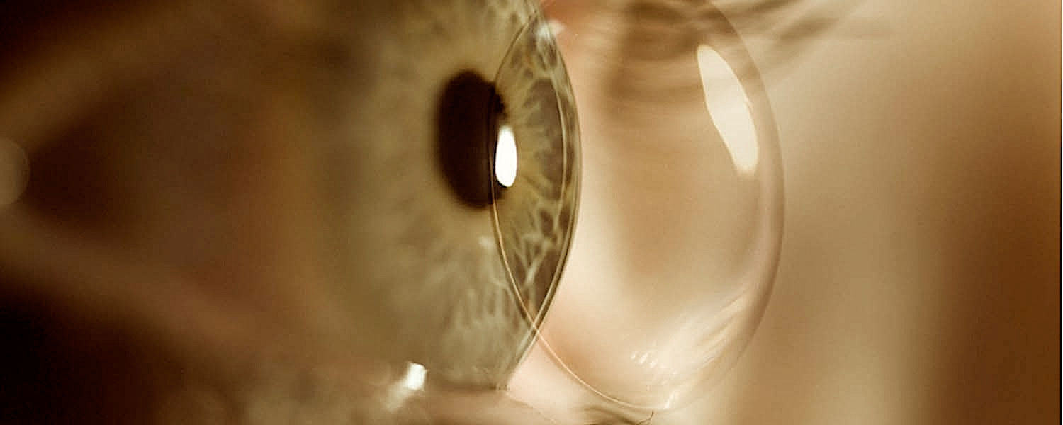 Jornadas Contactologia 2025