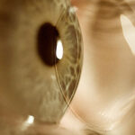 Jornadas de Contactología 2025