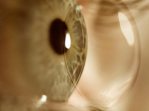 Jornadas de Contactología 2025